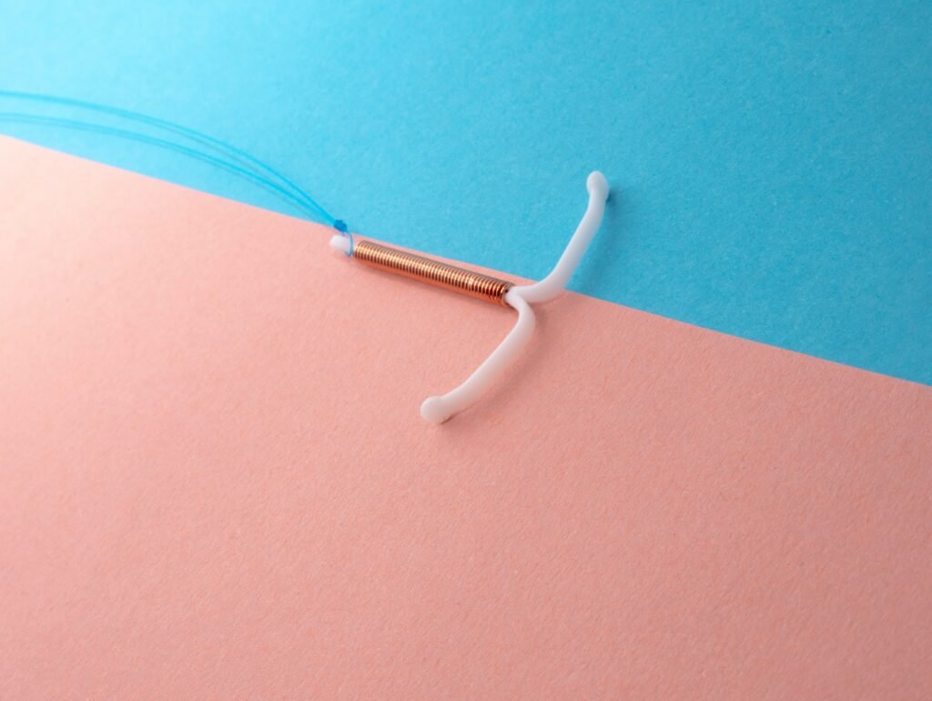 Imagem de um DIU (Dispositivo Intrauterino) utilizado como método contraceptivo de longa duração.
